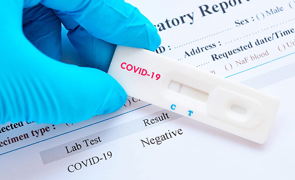 CRISI COVID-19: La Diputació comença a distribuir als ajuntaments els kits de detecció ràpida del coronavirus