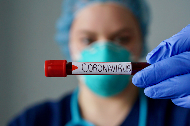 CRISI COVID-19: Preocupant augmenta de la velocitat de contagi i l’índex de risc a Esplugues de Llobregat